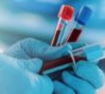 Bezpłatne badania profilaktyczne w kierunku Chorób Układu Krążenia Bezpłatne badania profilaktyczne w kierunku Chorób Układu Krążenia